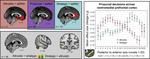 A comparative fMRI meta-analysis of altruistic and strategic decisions to give